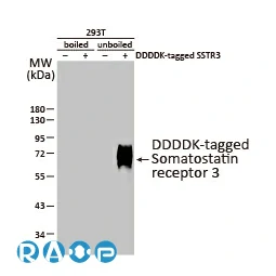 CXCR1 antibody [HL2674]